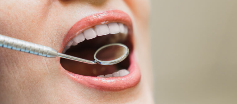 que incluye rehabilitacion oral