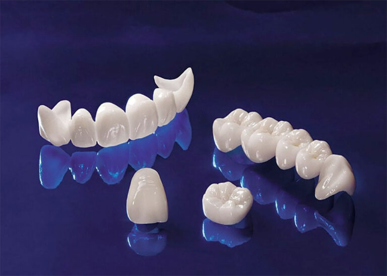 Piezas dentales de zirconio Silla Valencia