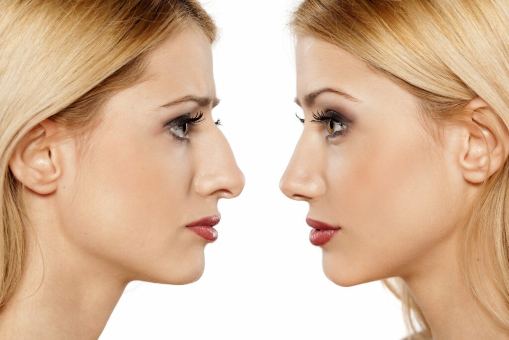 Estética facial Valencia