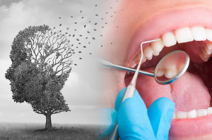 Salud bucal y Alzheimer